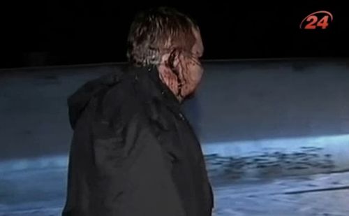 Файл:Булатов ухо.jpg